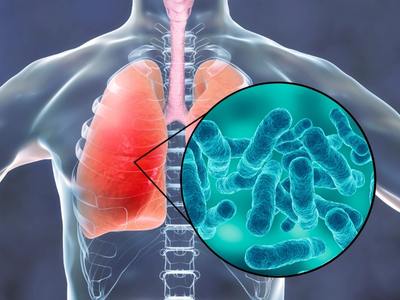 legionella infected lungs